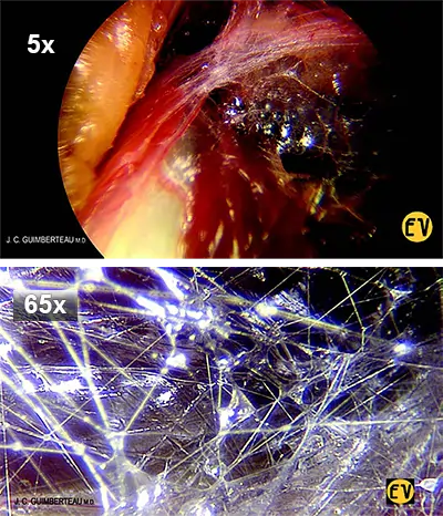 Fascia viewed from the microscope